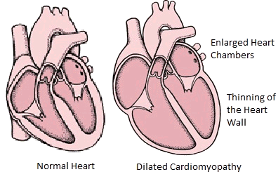 Cardiomyopathy in 2025 great danes